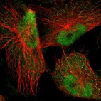 Immunofluorescent staining of human cell line U-251 MG shows localization to nucleoplasm.