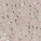 Immunohistochemical staining of human cerebral cortex shows moderate cytoplasmic positivity in neurons.
