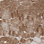 Immunohistochemical staining of human skeletal muscle shows moderate to strong cytoplasmic positivity in myocytes.