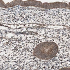 Immunohistochemical staining of human endometrium shows moderate to strong cytoplasmic positivity in glandular cells.