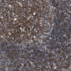 Immunohistochemical staining of human tonsil shows high expression.