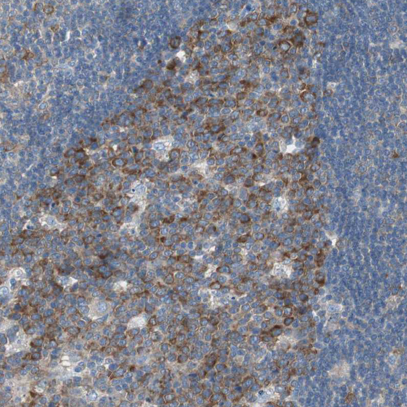 Anti-RPS12 Antibody