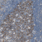 Anti-RPS12 Antibody