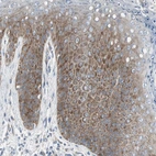 Immunohistochemical staining of human skin shows moderate cytoplasmic positivity in squamous epithelial cells.