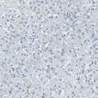 Anti-RPS12 Antibody