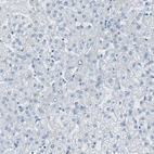 Immunohistochemical staining of human liver shows no positivity in hepatocytes as expected.