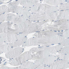 Immunohistochemical staining of human skeletal muscle shows no positivity in myocytes as expected.