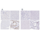 Anti-CXorf67 Antibody