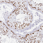 Anti-CXorf67 Antibody