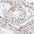 Immunohistochemical staining of human testis shows moderate to strong nuclear positivity in cells in seminiferous ducts.