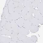 Immunohistochemical staining of human skeletal muscle shows no positivity in myocytes as expected.