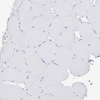 Immunohistochemical staining of human skeletal muscle shows no positivity in myocytes as expected.