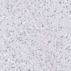 Immunohistochemical staining of human liver shows no positivity in hepatocytes as expected.
