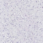 Immunohistochemical staining of human liver shows no positivity in hepatocytes as expected.