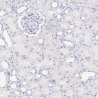 Anti-CXorf67 Antibody