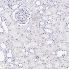 Immunohistochemical staining of human kidney shows no positivity in cells in tubules as expected.