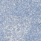 Immunohistochemical staining of human tonsil shows no positivity in non-germinal center cells as expected.