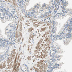 Anti-FLNC Antibody