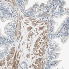 Immunohistochemical staining of human prostate shows moderate cytoplasmic positivity in smooth muscle cells.