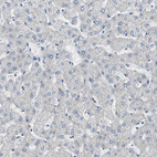 Immunohistochemical staining of human liver shows no positivity in hepatocytes as expected.