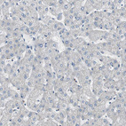 Anti-FLNC Antibody