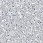 Immunohistochemical staining of human liver shows no positivity in hepatocytes as expected.