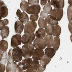 Immunohistochemical staining of human skeletal muscle shows strong cytoplasmic positivity in myocytes.