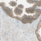 Immunohistochemical staining of human prostate shows moderate cytoplasmic positivity in glandular cells.
