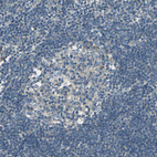 Anti-SHC2 Antibody