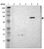 Lane 1: Marker [kDa] 229, 112, 84, 48, 32, 27, 17_br/_Lane 2: Human cell line RT-4_br/_Lane 3: Human cell line U-251MG sp_br/_Lane 4: Human plasma (IgG/HSA depleted)_br/_Lane 5: Human liver tissue_br/_Lane 6: Human tonsil tissue