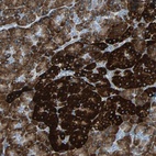 Anti-PDIA4 Antibody