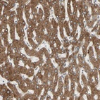 Anti-PDIA4 Antibody