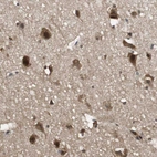 Immunohistochemical staining of human cerebral cortex shows strong cytoplasmic-nuclear positivity in neurons.