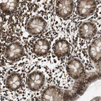 Immunohistochemical staining of human colon shows moderate nuclear positivity in glandular cells.