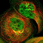 Immunofluorescent staining of human cell line A-431 shows localization to nucleoplasm, plasma membrane, cytosol & the Golgi apparatus.