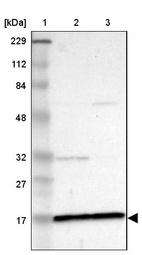 Lane 1: Marker [kDa] 229, 112, 84, 48, 32, 27, 17_br/_Lane 2: Human cell line RT-4_br/_Lane 3: Human cell line U-251MG sp