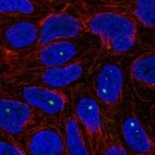 Immunofluorescent staining of human cell line RT4 shows localization to nuclear bodies.