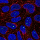 Immunofluorescent staining of human cell line RT4 shows localization to nuclear bodies.