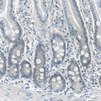 Immunohistochemical staining of human duodenum shows low expression as expected.