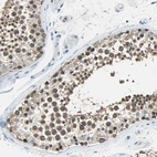 Immunohistochemical staining of human testis shows high expression.