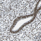 Immunohistochemical staining of human endometrium shows strong nuclear positivity in glandular cells.
