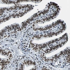 Immunohistochemical staining of human fallopian tube shows strong nuclear positivity in glandular cells.