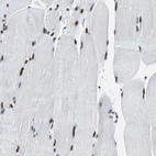 Immunohistochemical staining of human skeletal muscle shows strong nuclear positivity in myocytes.