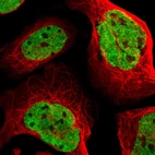 Immunofluorescent staining of human cell line U-2 OS shows localization to nucleoplasm.