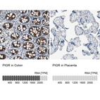 Anti-PIGR Antibody