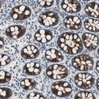 Immunohistochemical staining of human colon shows strong cytoplasmic positivity in glandular cells.