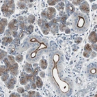 Immunohistochemical staining of human salivary gland shows strong membranous positivity in glandular cells.