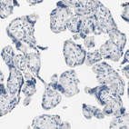 Anti-PIGR Antibody