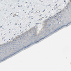 Anti-PIGR Antibody