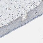 Immunohistochemical staining of human skin shows no cytoplasmic positivity in squamous epithelial cells as expected.